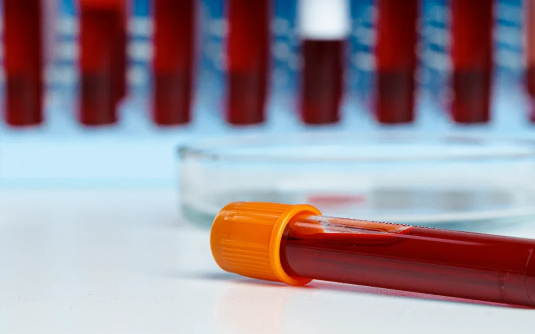 BioChain 4.0: la logistica diagnostica diventa intelligente